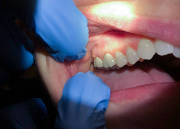 Best Emergency Treatment for Toothache in Tybee Island, GA