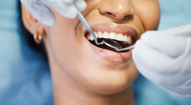 Best Emergency Wisdom Teeth Removal in Tybee Island, GA