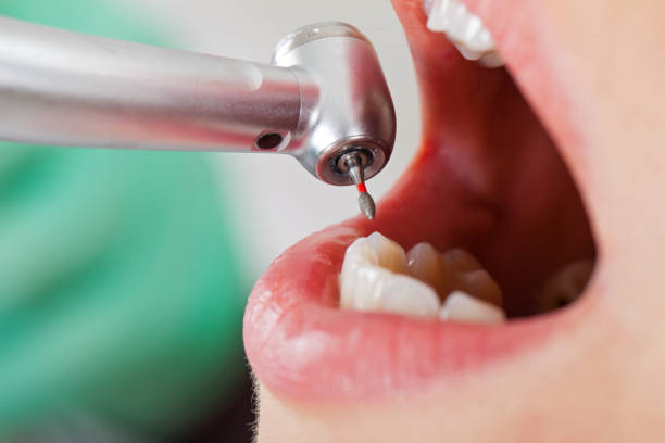 Best Pediatric Emergency Dentist in Tybee Island, GA